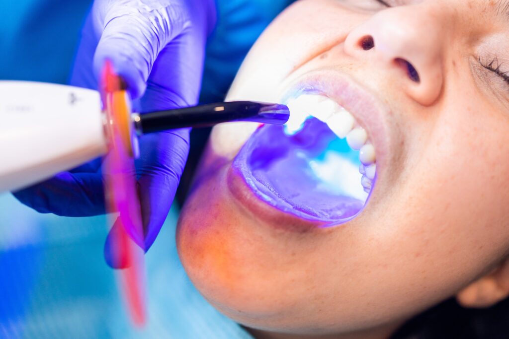 dental fillings Whitesboro